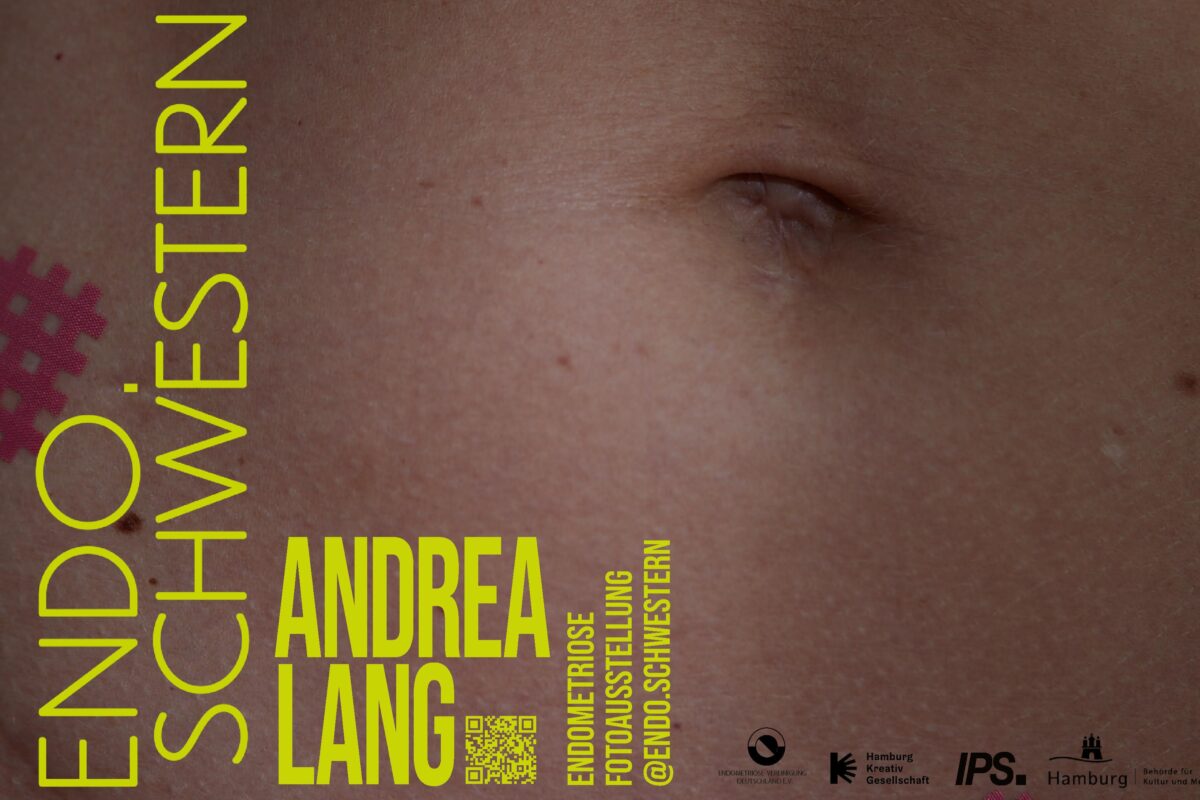 Fotoausstellung ENDOSCHWESTERN 28.12.2024 - 04.01.2025 für die Öffentlichkeitsarbeit von Endometriose by Andrea Lang.
